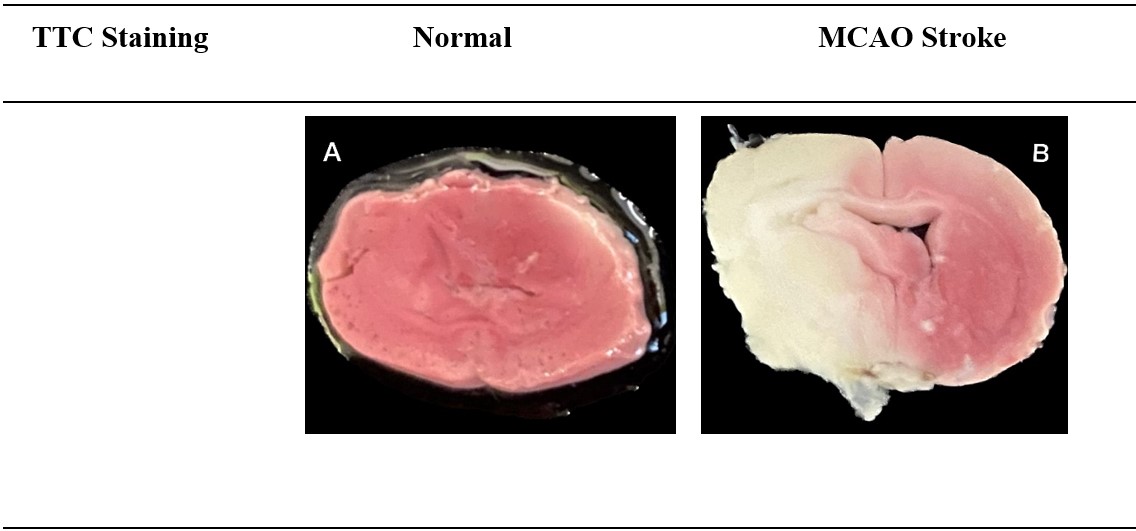 FIGURE 1: Representative images of 2,3,5-triphenyltetrazolium chloride (TTC) stained brain slices; (A) The normal group's rat brain had no differences in colouring; (B) The infarcted (white) and non-infarcted (red) areas of the rat brain were clearly separated by the MCAO stroke model