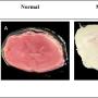 FIGURE 1: Representative images of 2,3,5-triphenyltetrazolium chloride (TTC) stained brain slices; (A) The normal group's rat brain had no differences in colouring; (B) The infarcted (white) and non-infarcted (red) areas of the rat brain were clearly separated by the MCAO stroke model